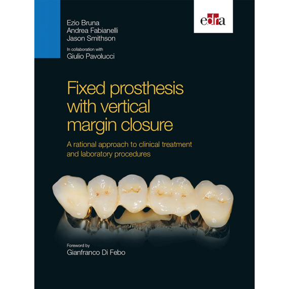 Fixed prosthesis with vertical margin closure