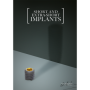 Short And Extra-Short Implants