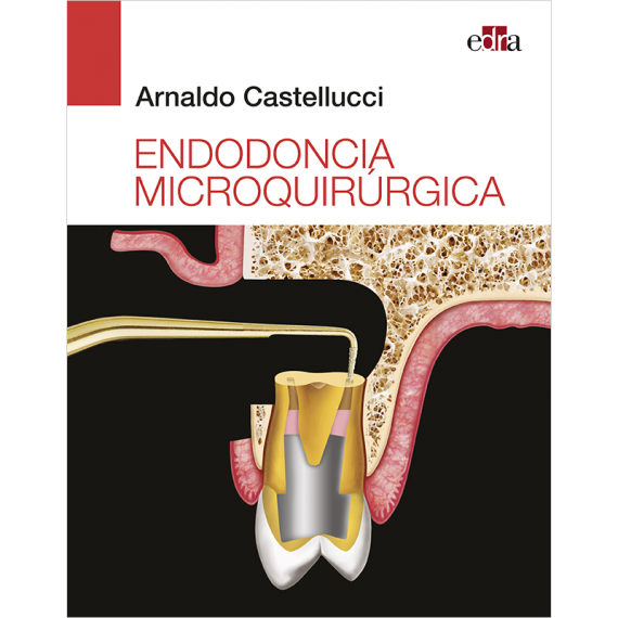 Endodoncia microquirúrgica