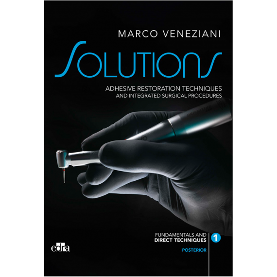 Solutions. Adhesive restoration techniques restorative and integrated surgical procedures. Posterior