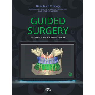 Guided Surgery