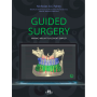 Guided Surgery