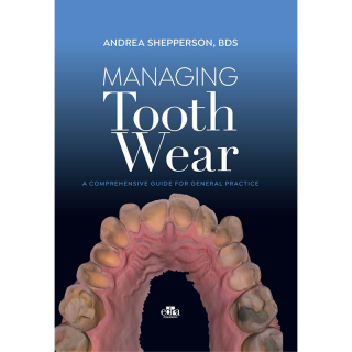 Managing Tooth Wear